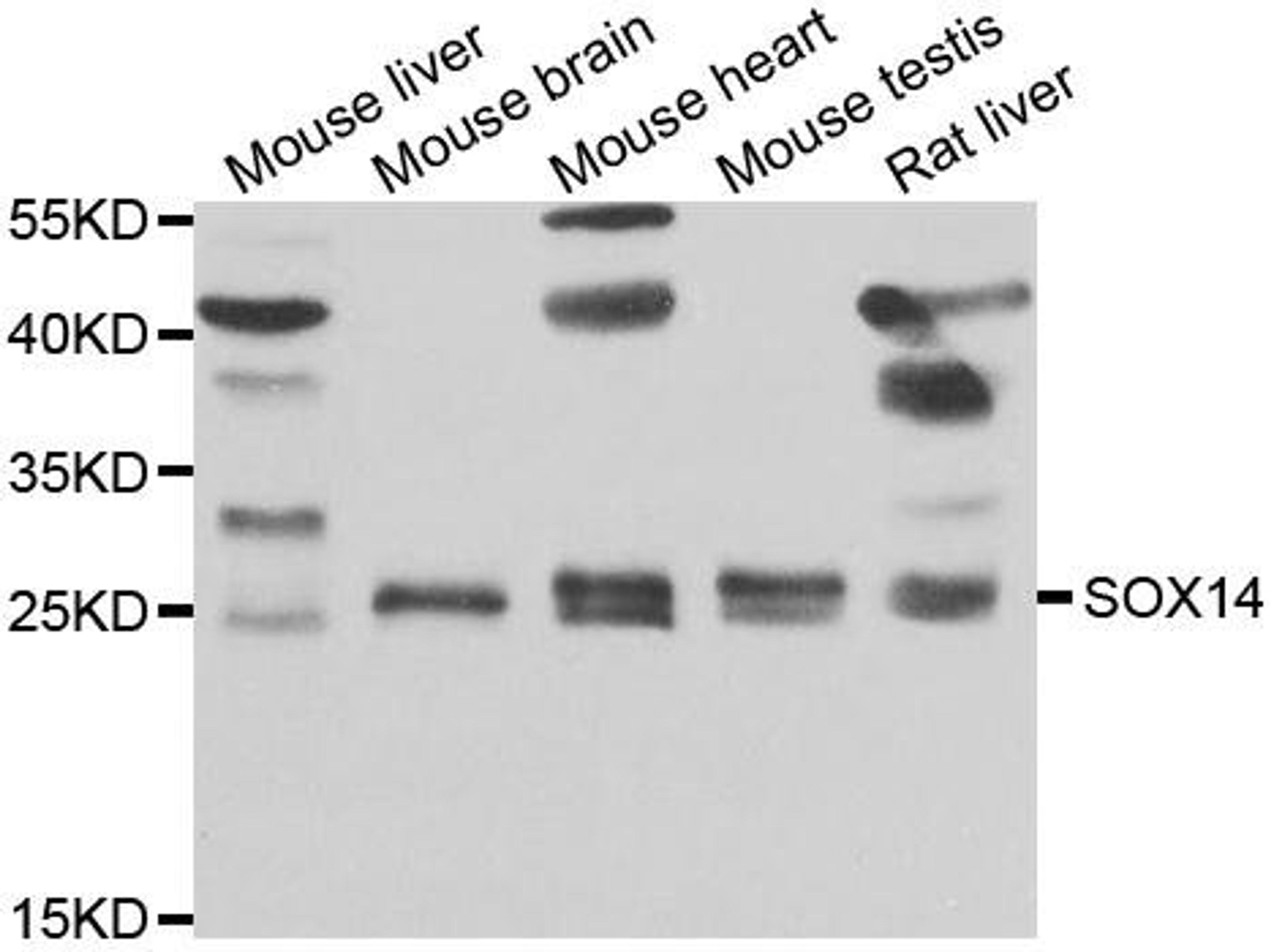 Western blot analysis of extracts of various cell lines using SOX14 antibody