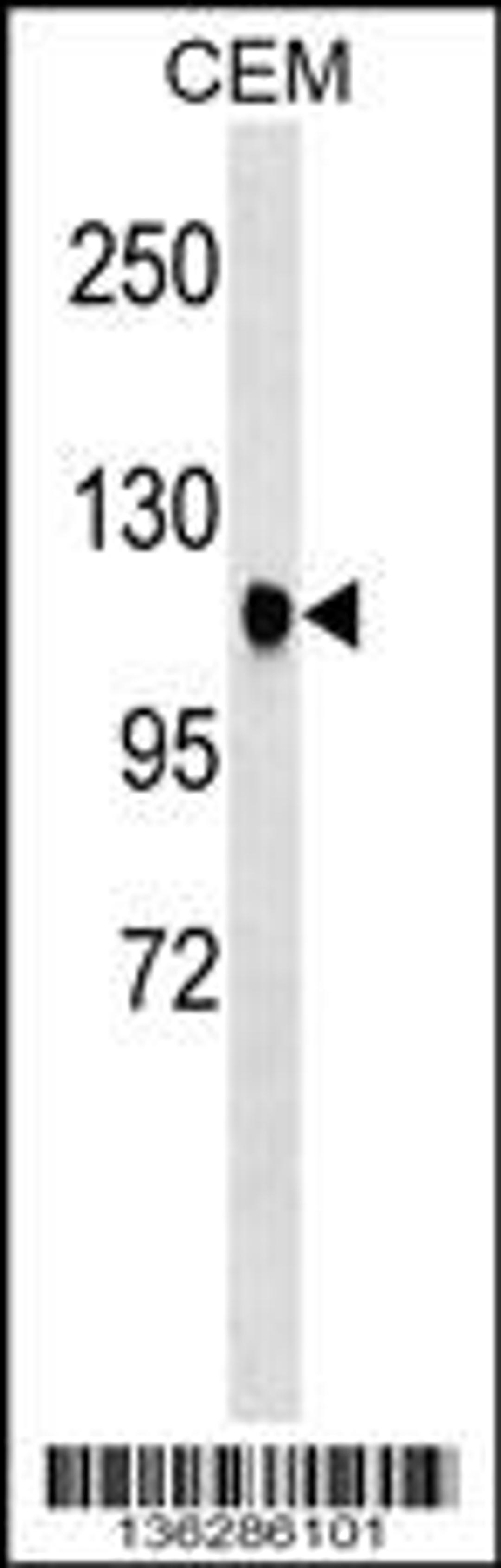 Western blot analysis in CEM cell line lysates (35ug/lane).