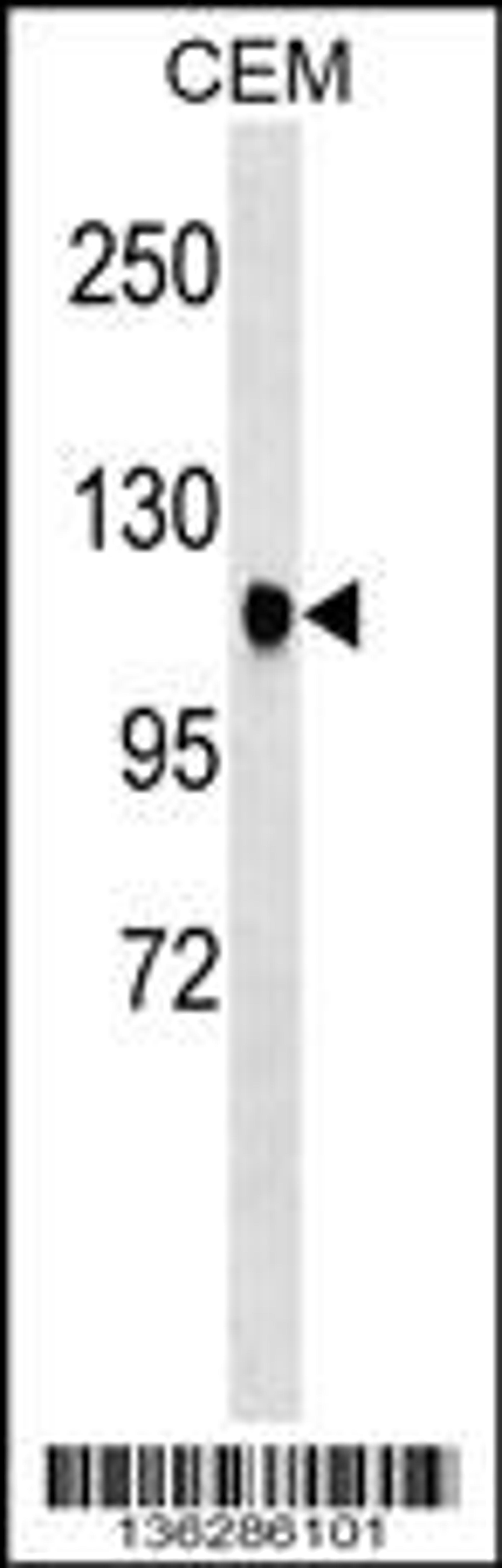 Western blot analysis in CEM cell line lysates (35ug/lane).