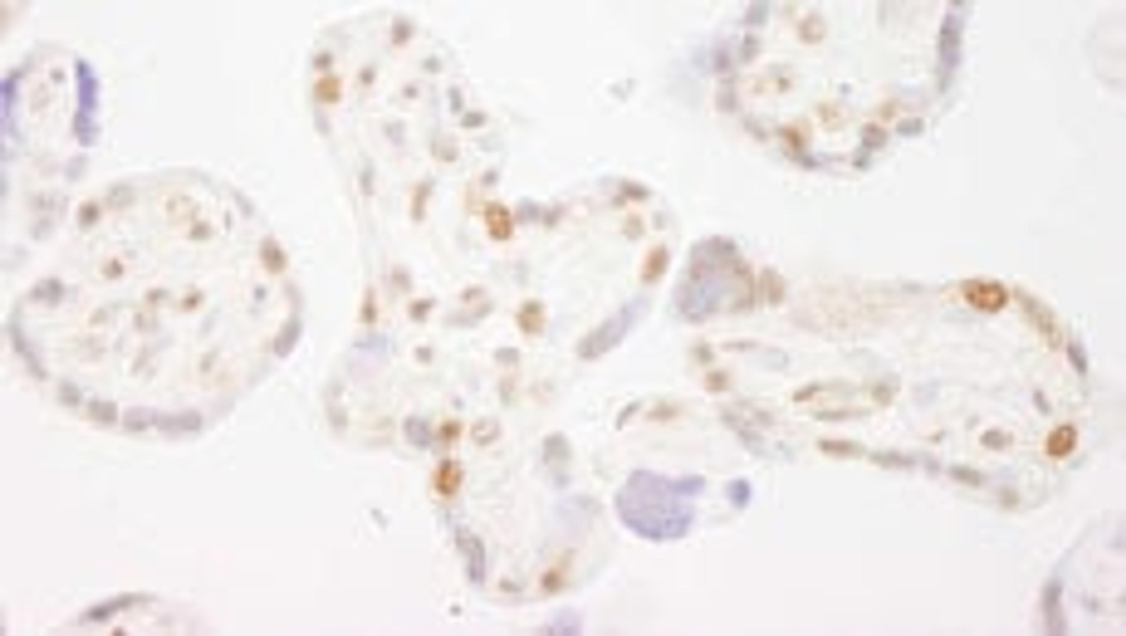 Detection of human COBRA1 by immunohistochemistry.