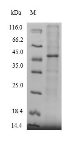 (Tris-Glycine gel) Discontinuous SDS-PAGE (reduced) with 5% enrichment gel and 15% separation gel.