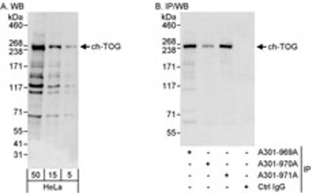 Detection of human ch-TOG by western blot and immunoprecipitation.