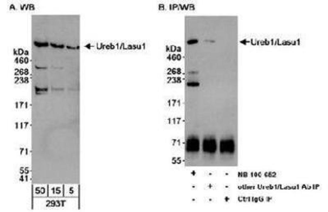 Western Blot: HUWE1 Antibody [NB100-652] - Whole cell lysate (5, 15 and 50 ug for WB; 1 mg for IP) from 293T cells.  Ureb1/Lasu1 was less efficiently immunoprecipitated by another Ureb1/Lasu1 antibody.