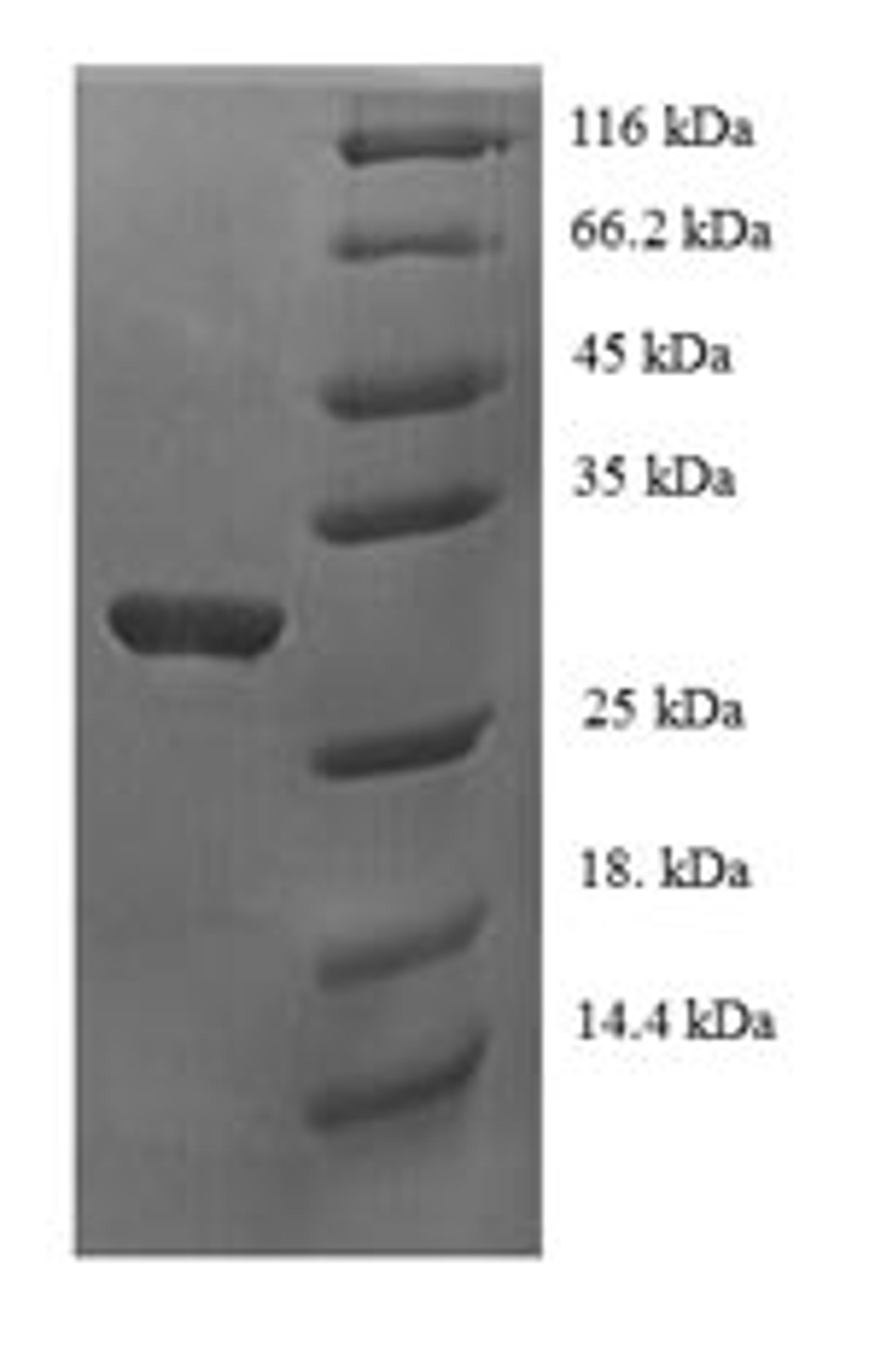 (Tris-Glycine gel) Discontinuous SDS-PAGE (reduced) with 5% enrichment gel and 15% separation gel.
