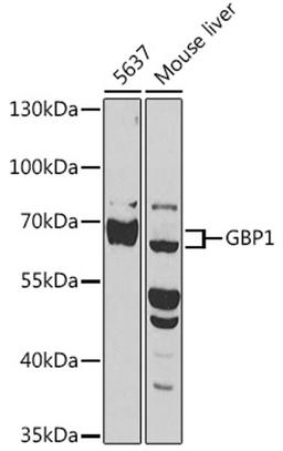 Western blot - GBP1 antibody (A3879)