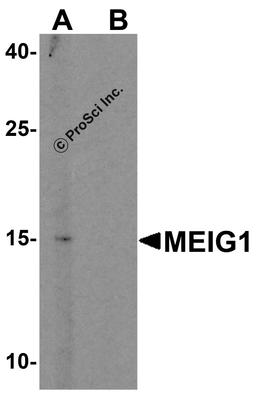 Western blot analysis of MEIG in mouse lung tissue lysate with MEIG antibody at 1 μg/mL in (A) the absence and (B) the presence of blocking peptide.