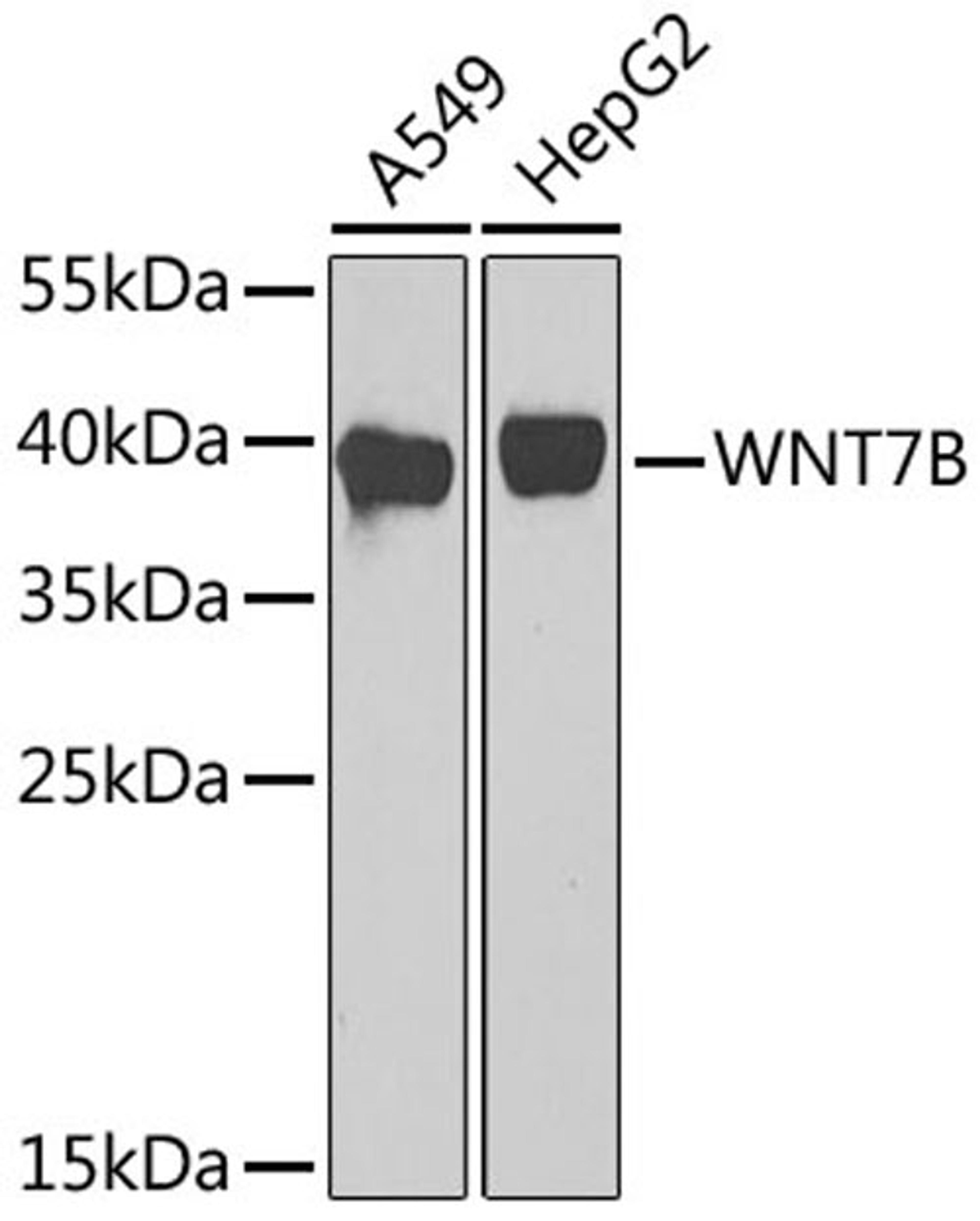 Western blot - WNT7B antibody (A17004)