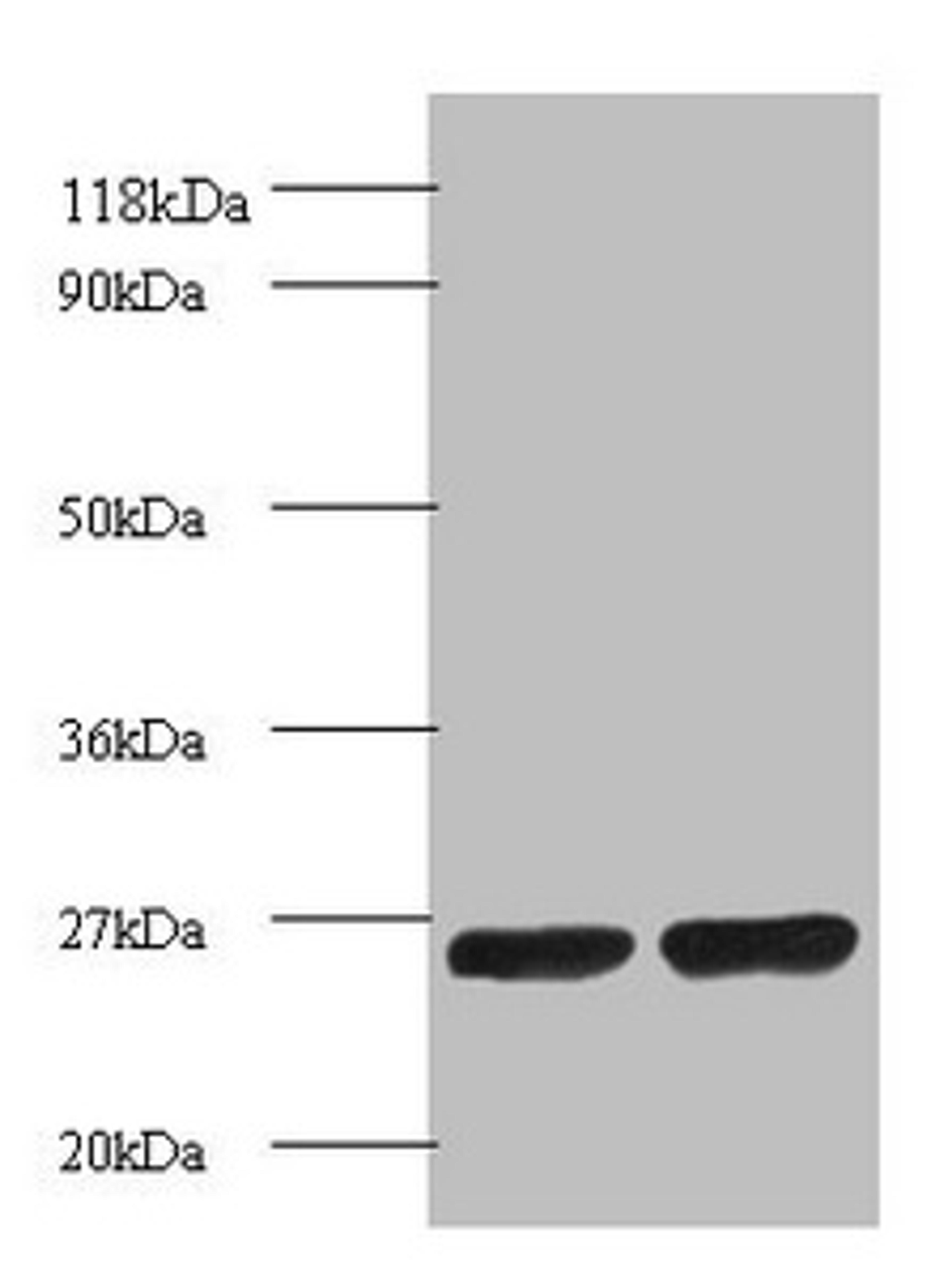 Western blot. All lanes: Proteasome subunit beta 1 antibody at 2ug/ml. Lane 1: EC109 whole cell lysate. Lane 2: 293T whole cell lysate. Secondary. Goat polyclonal to rabbit IgG at 1/15000 dilution. Predicted band size: 27 kDa. Observed band size: 27 kDa. 