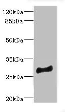 Western blot. All lanes: MLF1 antibody at 4.05ug/ml + Mouse brain tissue. Secondary. Goat polyclonal to rabbit IgG at 1/10000 dilution. Predicted band size: 31, 24, 34, 28, 30 kDa. Observed band size: 31 kDa. 