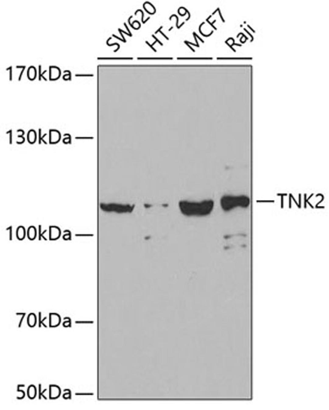 Western blot - TNK2 antibody (A2526)