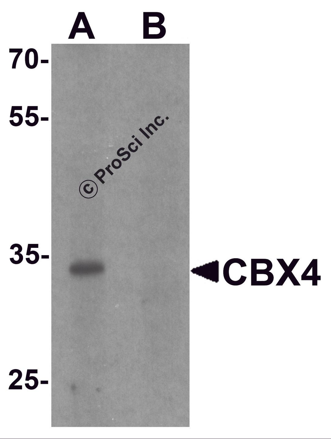 Western blot analysis of CBX4 in human brain tissue lysate with CBX4 antibody at 1 μg/ml in (A) the absence and (B) the presence of blocking peptide.