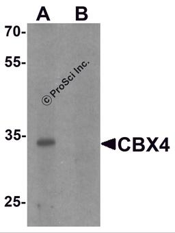 Western blot analysis of CBX4 in human brain tissue lysate with CBX4 antibody at 1 μg/ml in (A) the absence and (B) the presence of blocking peptide.