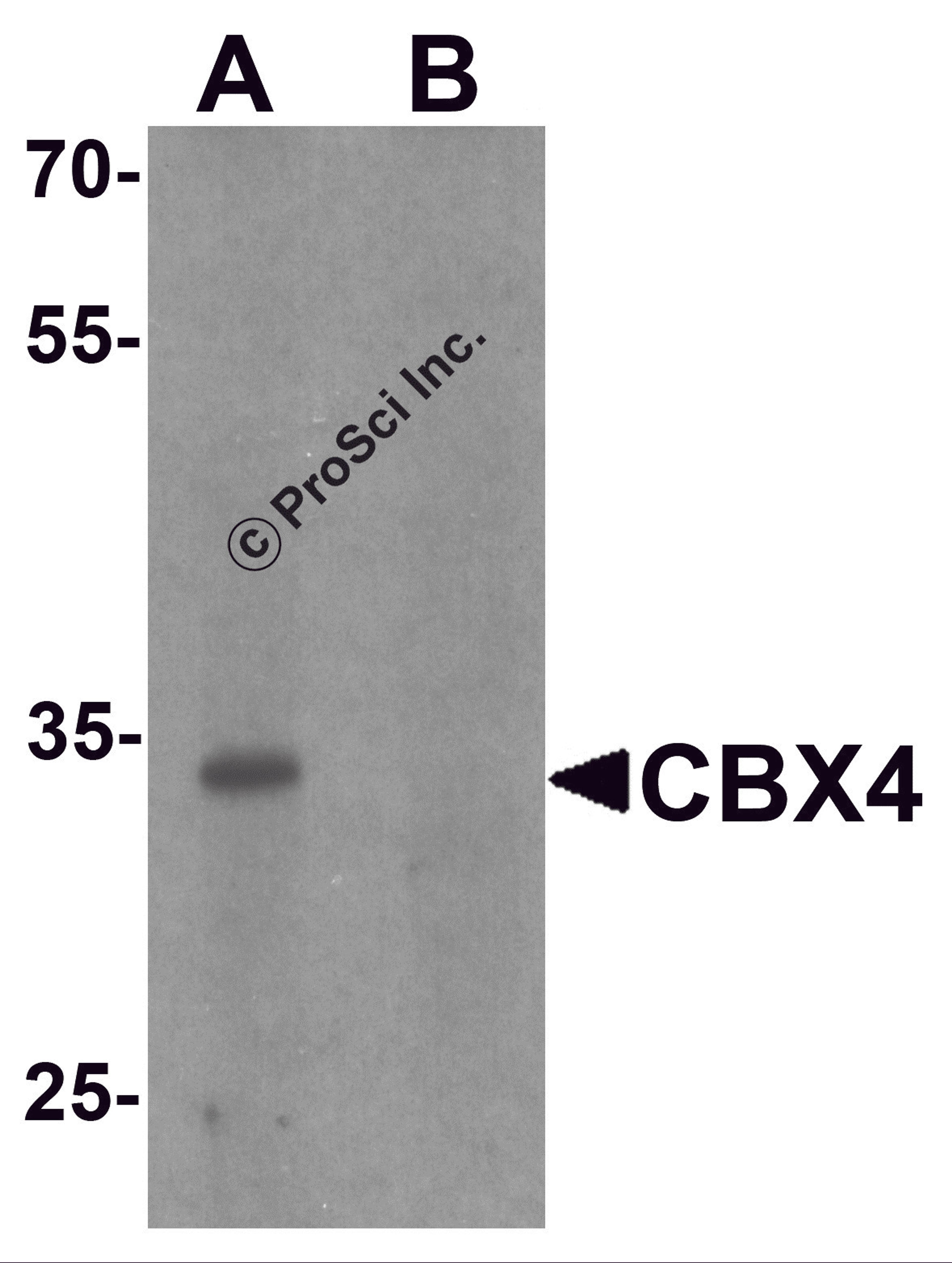 Western blot analysis of CBX4 in human brain tissue lysate with CBX4 antibody at 1 μg/ml in (A) the absence and (B) the presence of blocking peptide.