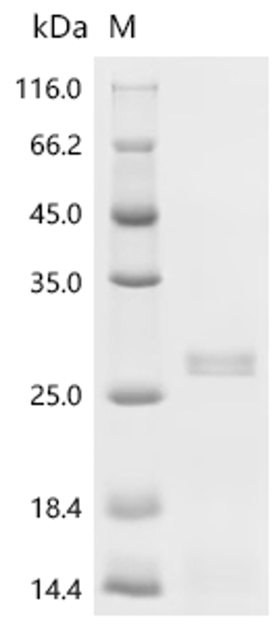 (Tris-Glycine gel) Discontinuous SDS-PAGE (reduced) with 5% enrichment gel and 15% separation gel.