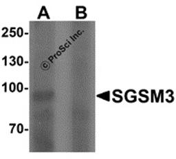 Western blot analysis of SGSM3 in 293 cell lysate with SGSM3 antibody at (A) 1 and (B) 2 &#956;g/mL.