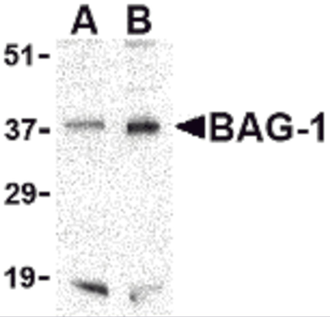 Western blot analysis of BAG-1 in PC-3 cell lysate with BAG-1 antibody at (A) 1 and (B) 2 &#956;g/mL.