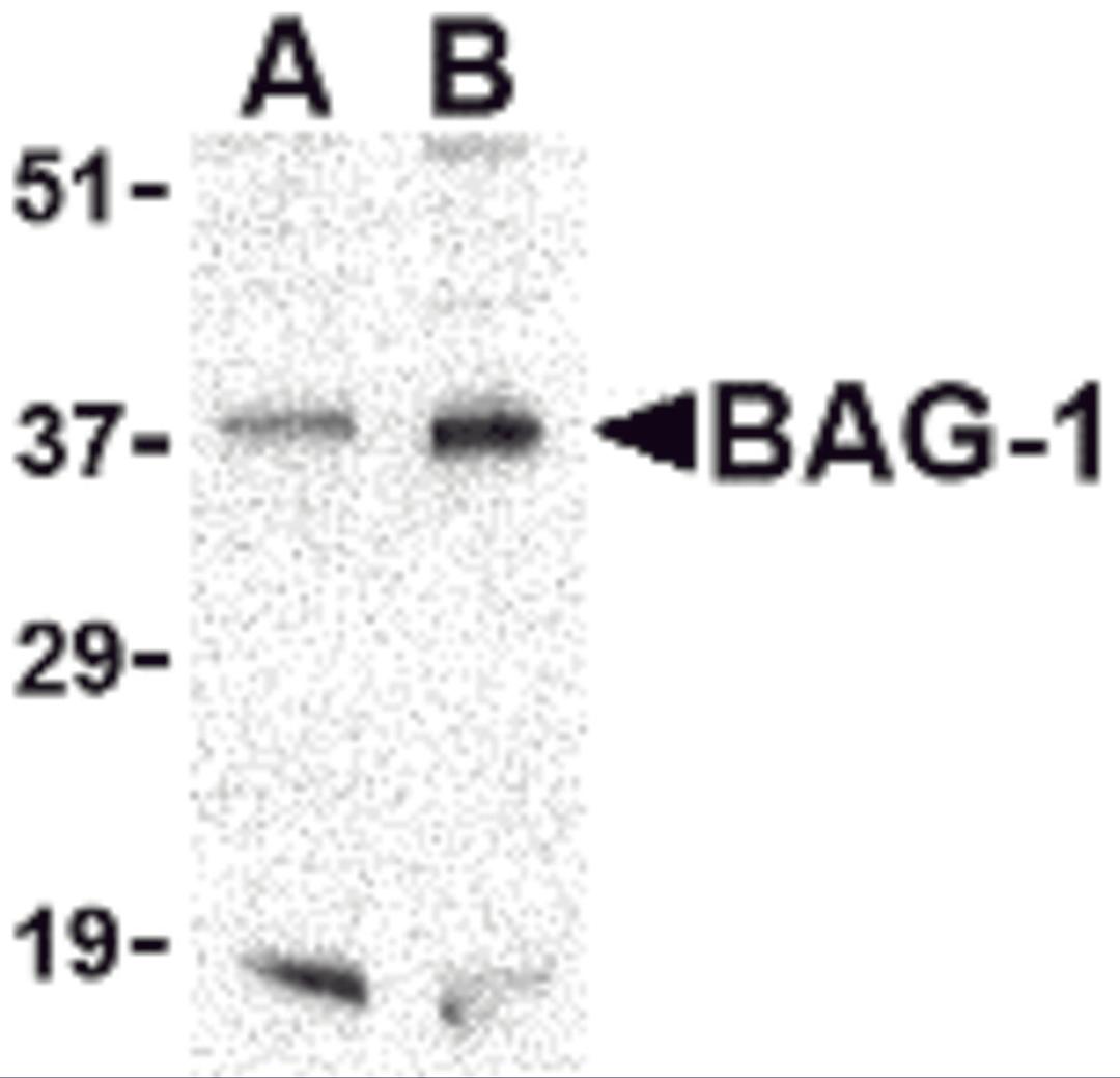 Western blot analysis of BAG-1 in PC-3 cell lysate with BAG-1 antibody at (A) 1 and (B) 2 μg/mL.