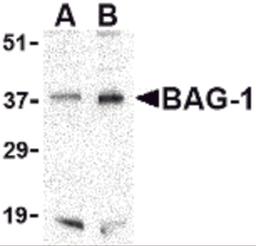 Western blot analysis of BAG-1 in PC-3 cell lysate with BAG-1 antibody at (A) 1 and (B) 2 μg/mL.