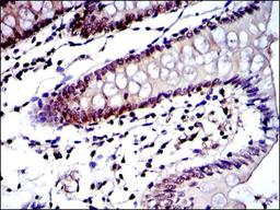 Immunohistochemistry: LMP7/PSMB8 Antibody (1A5) [NBP2-37570] - Immunohistochemical analysis of paraffin-embedded colon tissues using PSMB8 mouse mAb with DAB staining.