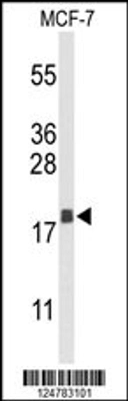 Western blot analysis of AGR3 Antibody in MCF-7 cell line lysates (35ug/lane)