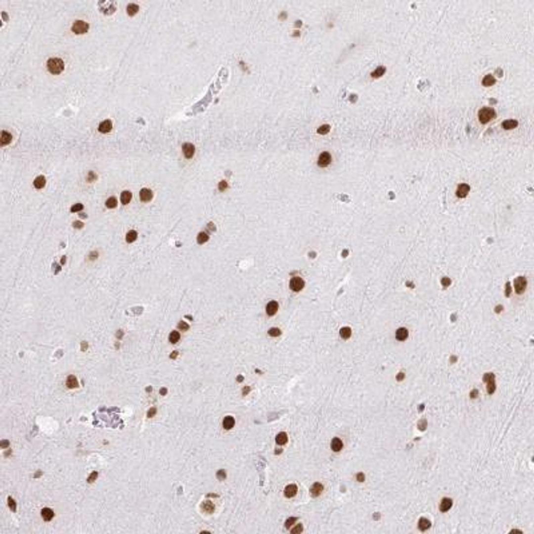 Immunohistochemistry: NPIPB3 Antibody [NBP2-46813] - Analysis of human cerebral cortex shows strong nuclear positivity in neuronal cells.