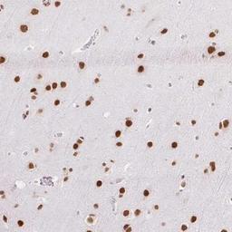 Immunohistochemistry: NPIPB3 Antibody [NBP2-46813] - Analysis of human cerebral cortex shows strong nuclear positivity in neuronal cells.