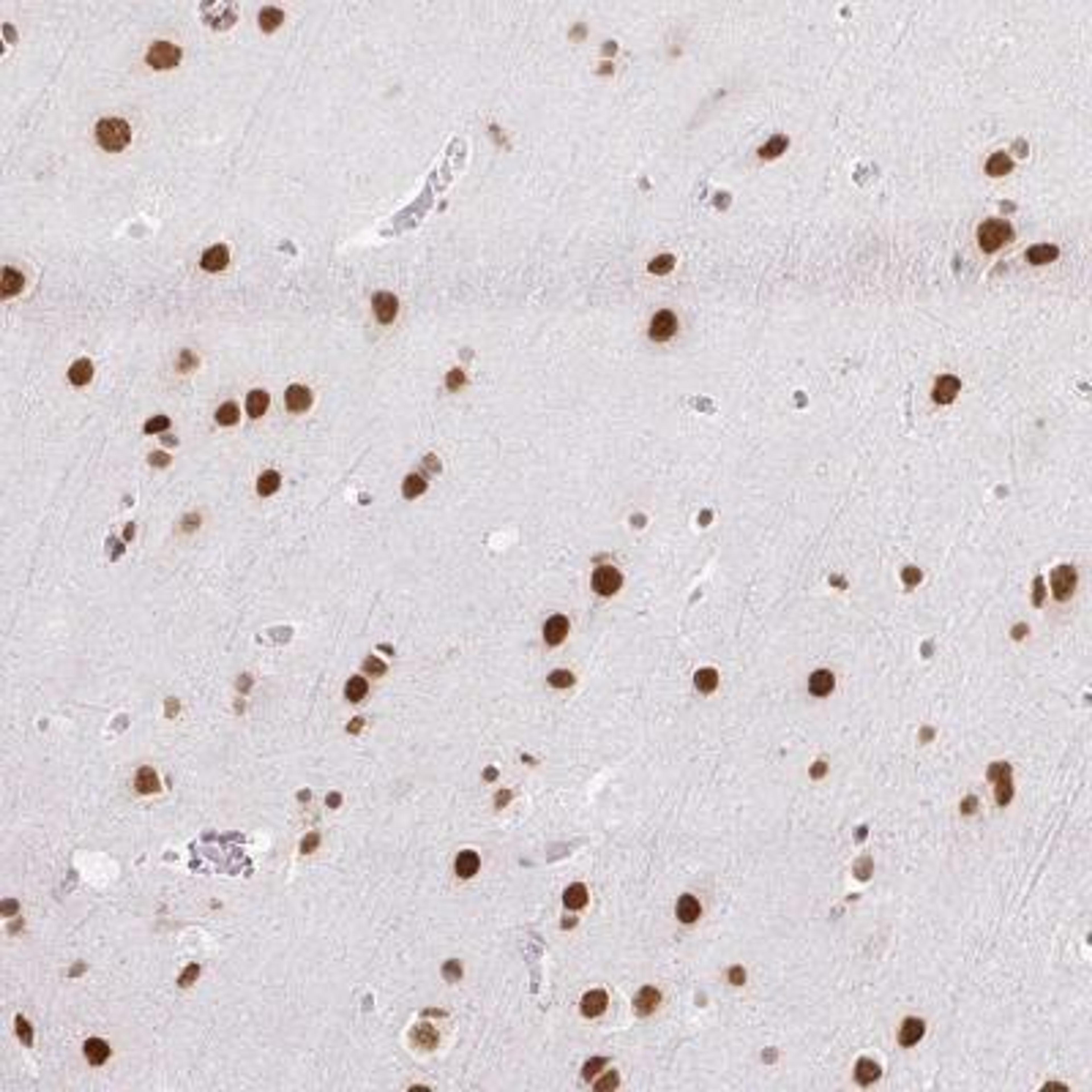 Immunohistochemistry: NPIPB3 Antibody [NBP2-46813] - Analysis of human cerebral cortex shows strong nuclear positivity in neuronal cells.