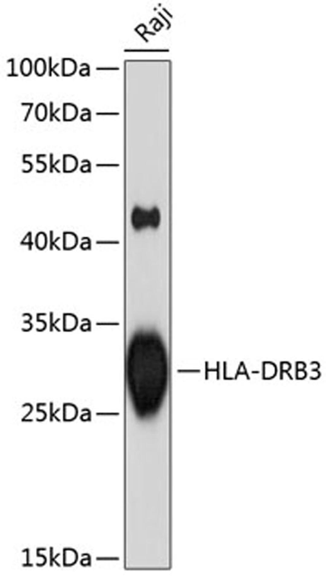 Western blot - HLA-DRB3 antibody (A1611)