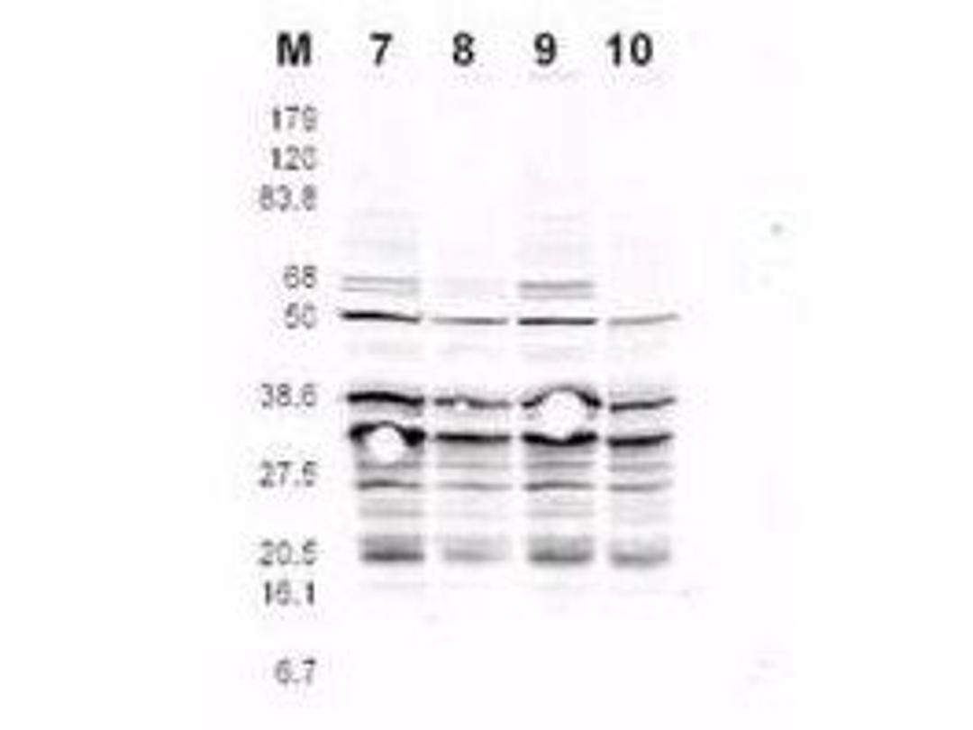 Western blot analysis of RFA2 containing cell lysates using RFA2 (phospho-S122) antibody