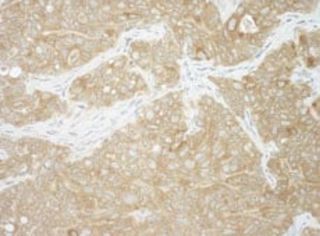 Detection of human AUP1 by immunohistochemistry.