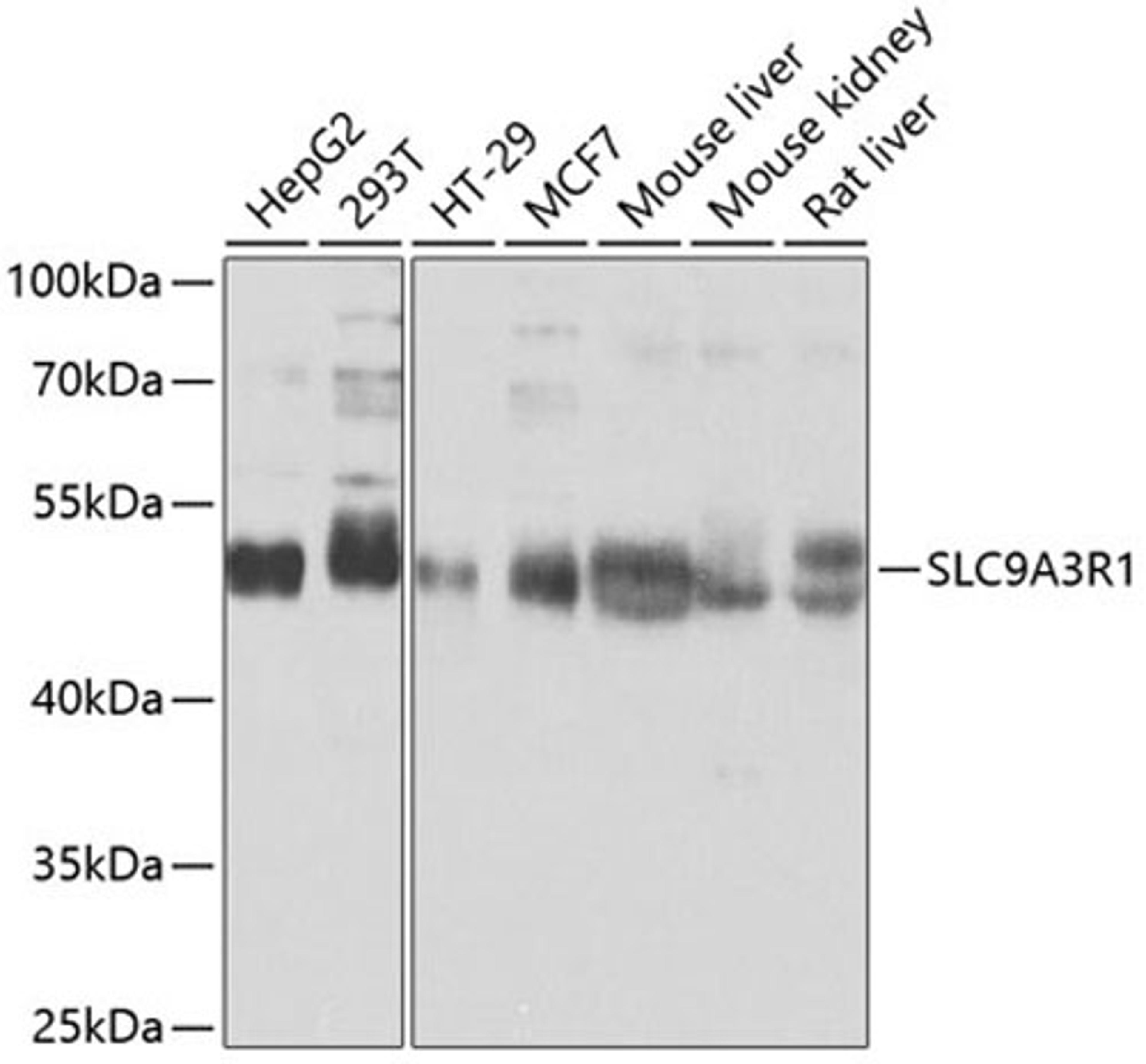 Western blot - SLC9A3R1 antibody (A0146)