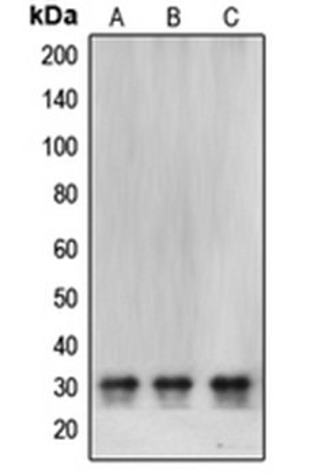 Western blot analysis of SHSY5Y (Lane 1), HeLa (Lane 2), MCF7 (Lane 3) whole cell lysates using CBR1 antibody