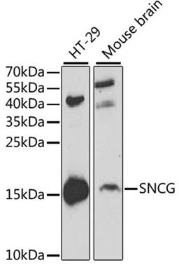 Western blot - SNCG antibody (A2524)