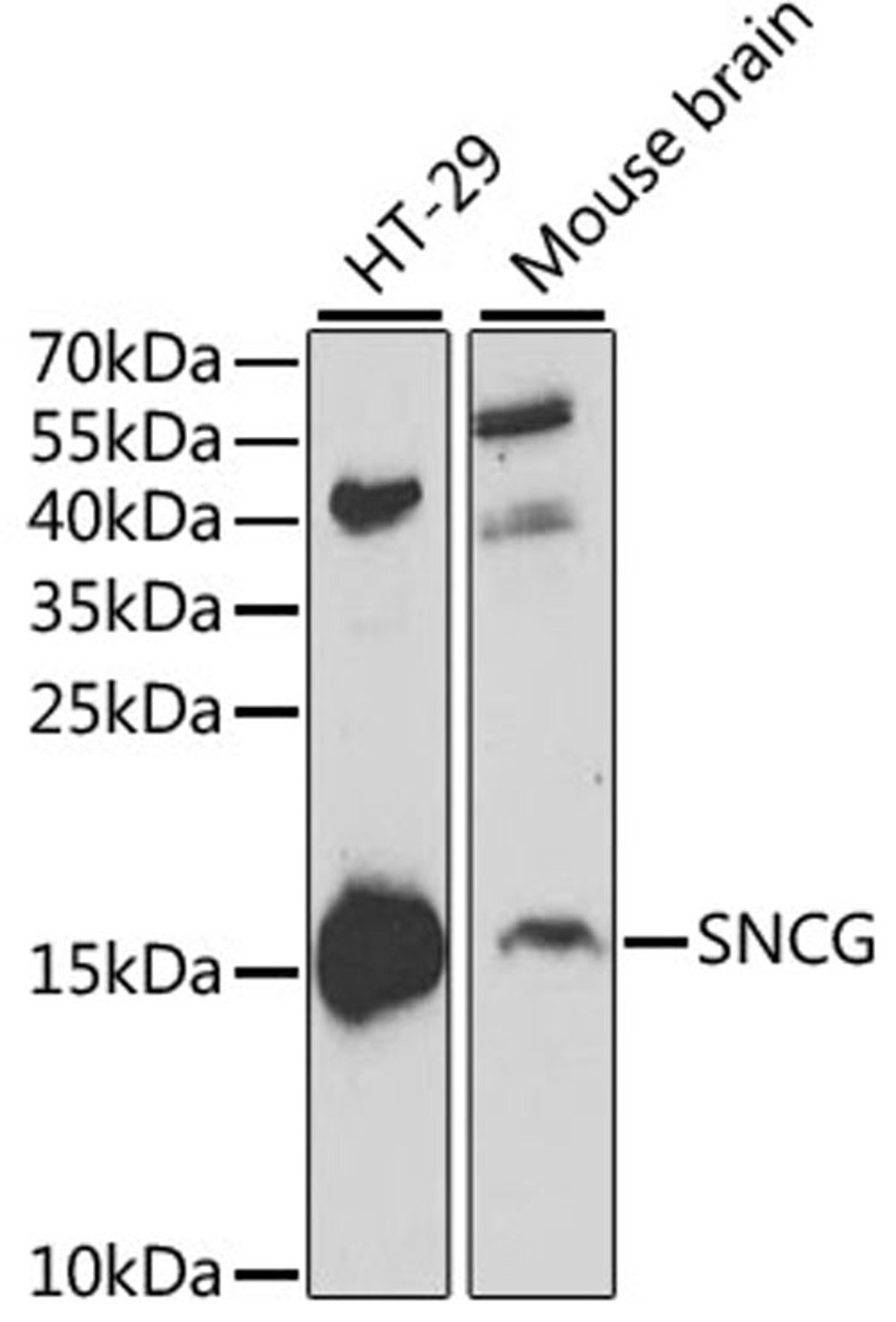 Western blot - SNCG antibody (A2524)