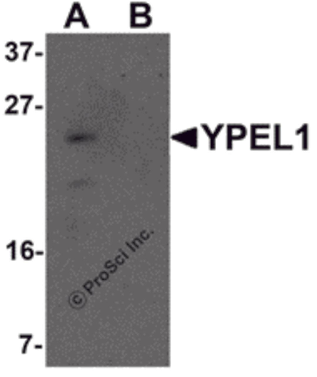 Western blot analysis of YPEL1 in Hela cell lysate with YPEL1 antibody at 1 μg/mL in (A) the absence and (B) the presence of blocking peptide.