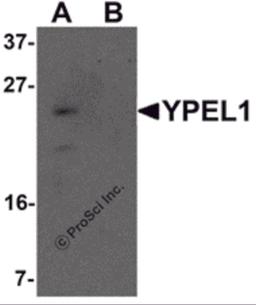 Western blot analysis of YPEL1 in Hela cell lysate with YPEL1 antibody at 1 μg/mL in (A) the absence and (B) the presence of blocking peptide.