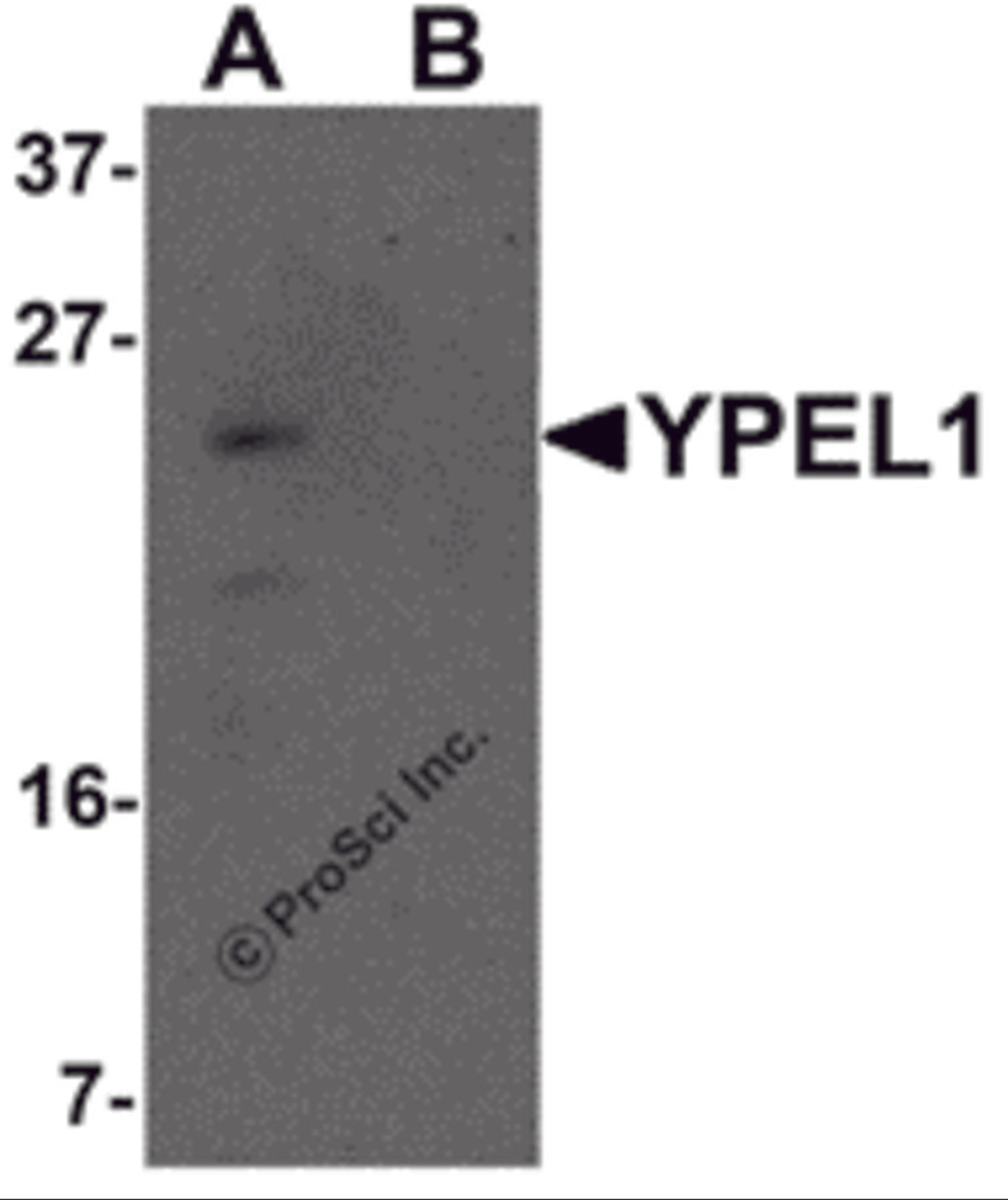 Western blot analysis of YPEL1 in Hela cell lysate with YPEL1 antibody at 1 μg/mL in (A) the absence and (B) the presence of blocking peptide.