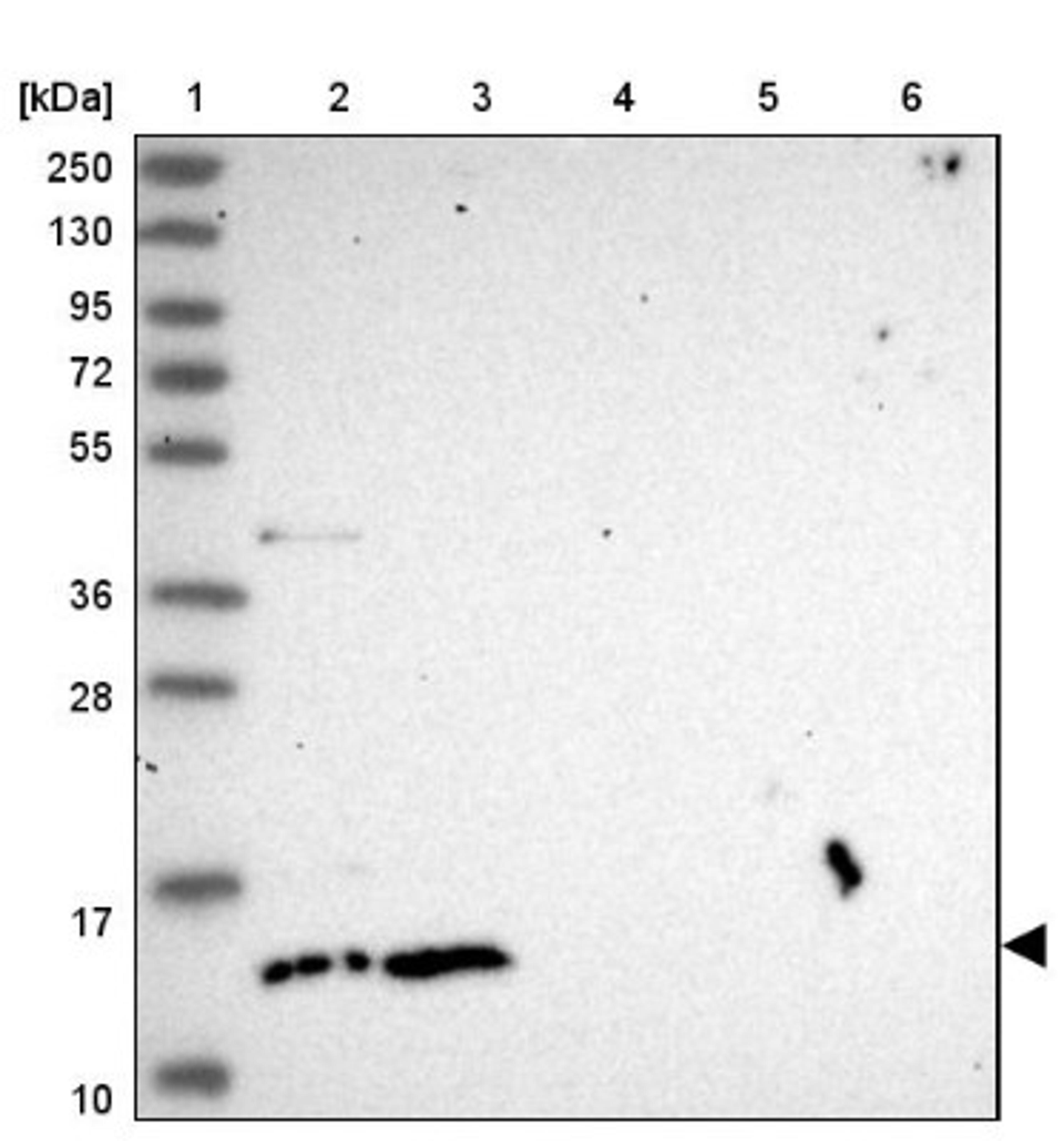 Western Blot: CCDC150 Antibody [NBP2-33514] - Lane 1: Marker [kDa] 250, 130, 95, 72, 55, 36, 28, 17, 10<br/>Lane 2: Human cell line RT-4<br/>Lane 3: Human cell line U-251MG sp<br/>Lane 4: Human plasma (IgG/HSA depleted)<br/>Lane 5: Human liver tissue<br/>Lane 6: Human tonsil tissue