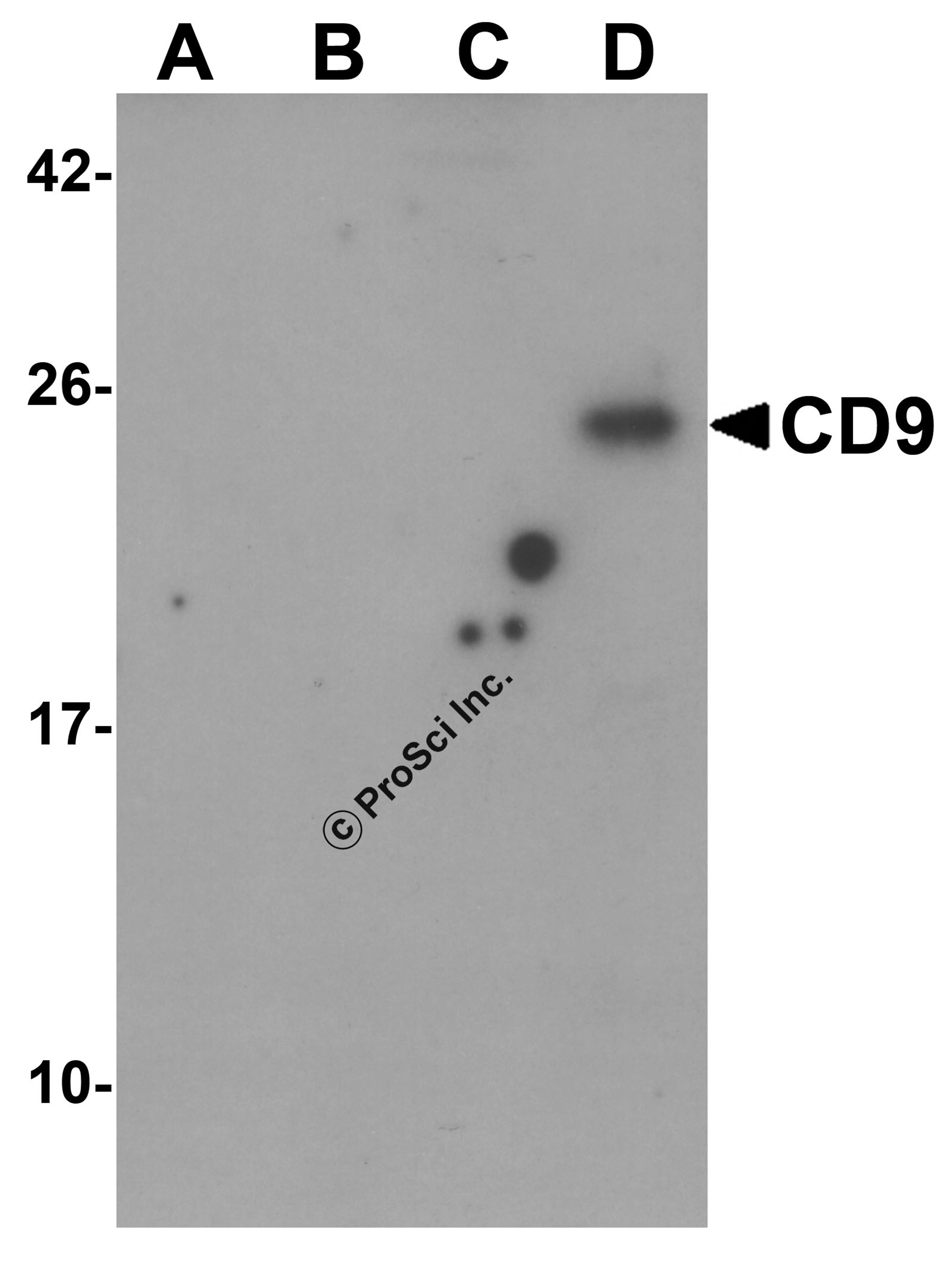 Western blot analysis of CD9 in (A) human ovary, (B) human uterus, (C) human ovary tumor, and (D) human uterus tumor tissue lysate with CD9 antibody at 1 μg/ml.
