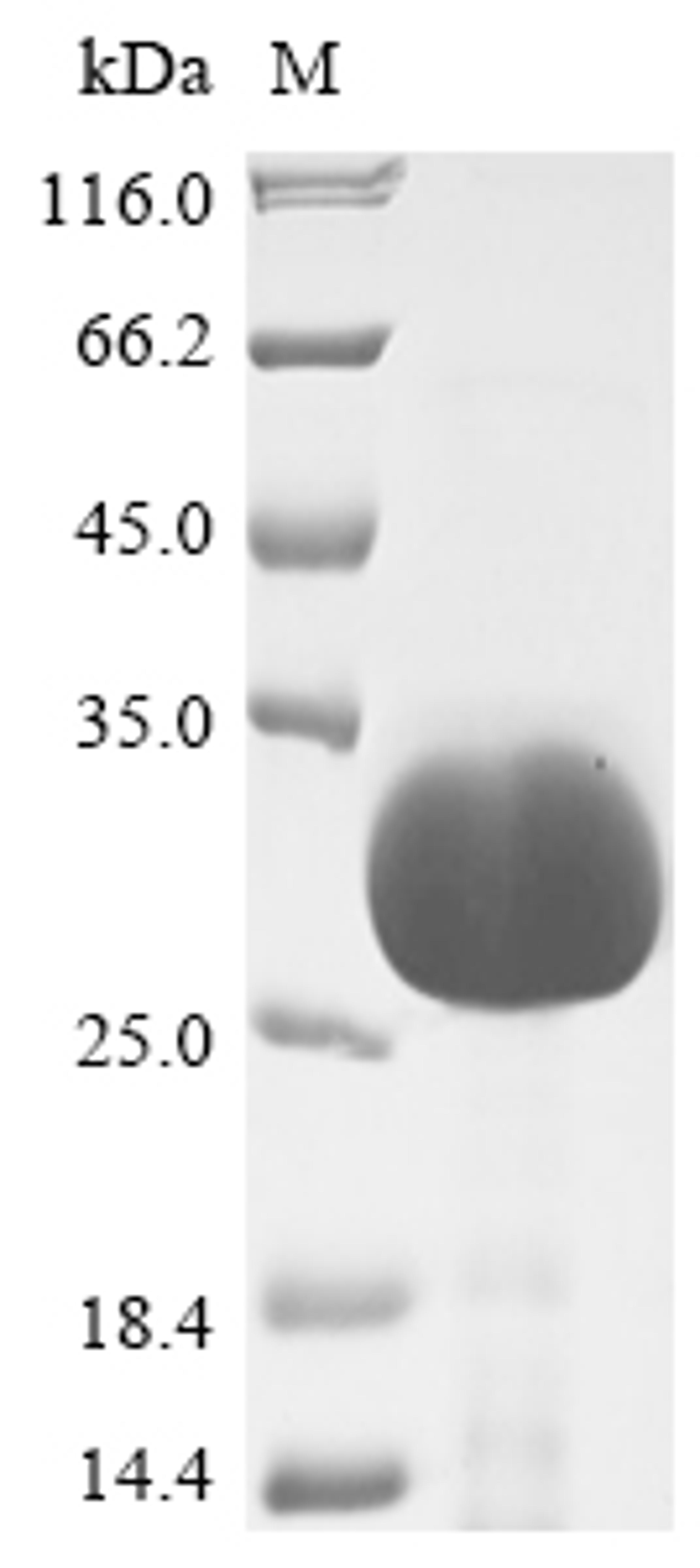 (Tris-Glycine gel) Discontinuous SDS-PAGE (reduced) with 5% enrichment gel and 15% separation gel.