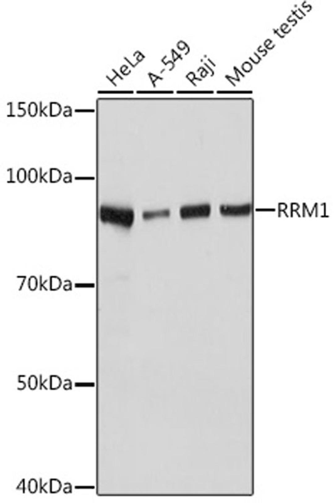 Western blot - RRM1 Rabbit mAb (A4259)