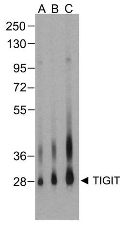 Western blot analysis of TIGIT in over expressing HEK293 cells using RF16056 antibody at (A) 0.25 μg/ml , (B) 0.5 μg/ml, and (C) 1 μg/ml.