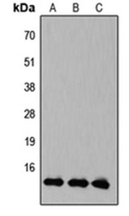 Western blot analysis of HEK293T (Lane1), Raw264.7 (Lane2), PC12 (Lane3) whole cell using KLF10/11 antibody