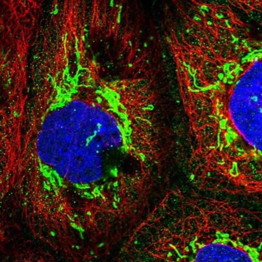 Immunocytochemistry/Immunofluorescence: Ring finger protein 138 Antibody [NBP1-86987] - Immunofluorescent staining of human cell line A-431 shows positivity in mitochondria.