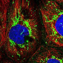 Immunocytochemistry/Immunofluorescence: Ring finger protein 138 Antibody [NBP1-86987] - Immunofluorescent staining of human cell line A-431 shows positivity in mitochondria.