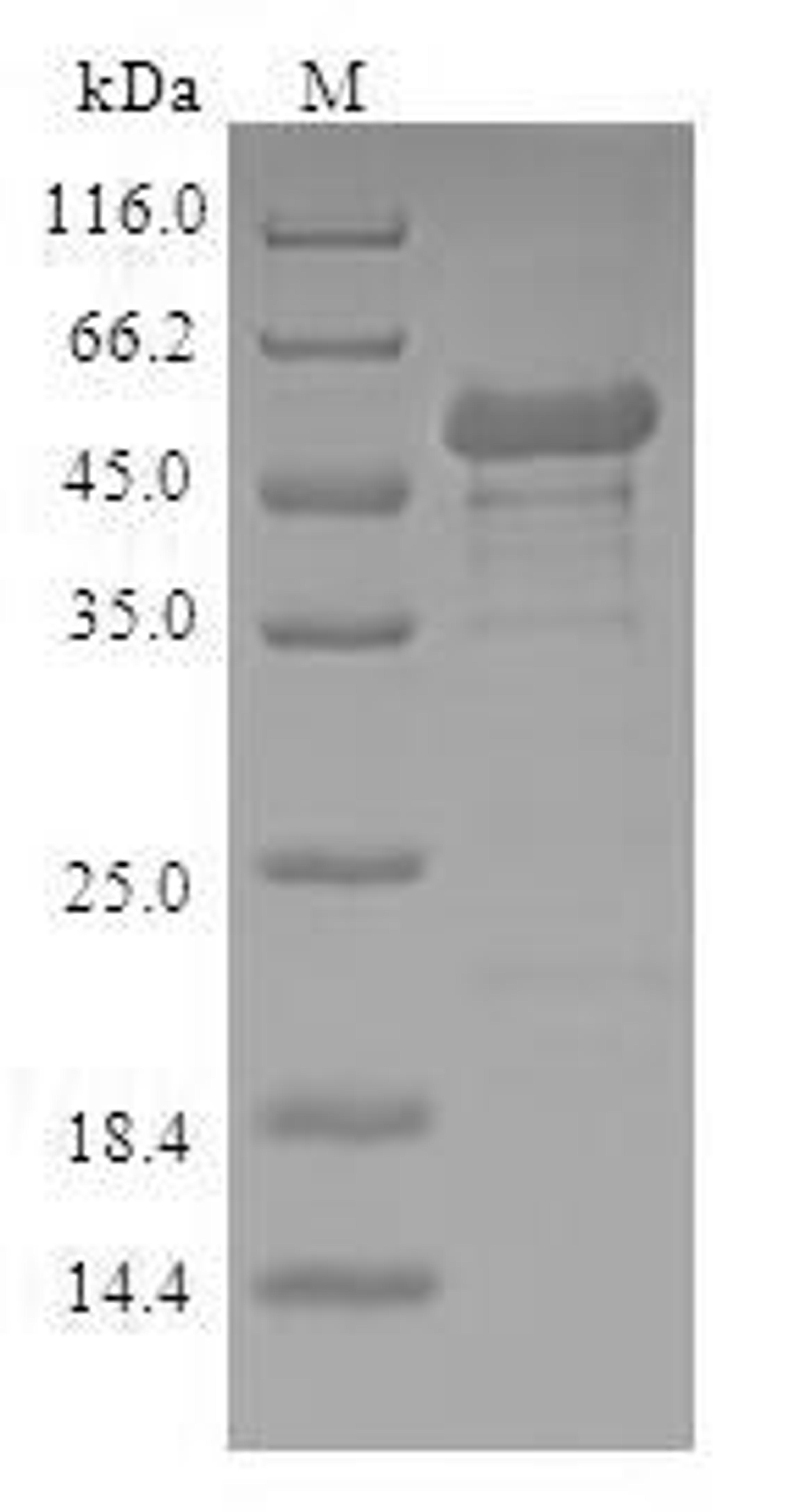 (Tris-Glycine gel) Discontinuous SDS-PAGE (reduced) with 5% enrichment gel and 15% separation gel.