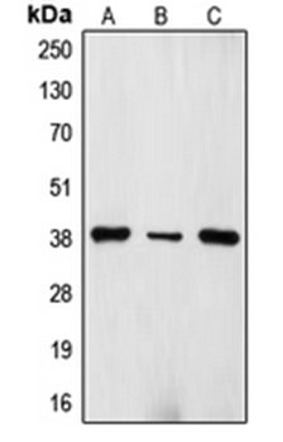 Western blot analysis of Molt4 (Lane 1), CCRFCEM (Lane 2), PBL (Lane 3) whole cell lysates using TRBC1 antibody