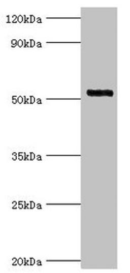 Western blot. All lanes: Interleukin-1 receptor-associated kinase 4 antibody at 4ug/ml + Jurkat whole cell lysate. Secondary. Goat polyclonal to rabbit IgG at 1/10000 dilution. Predicted band size: 52, 38 kDa. Observed band size: 52 kDa.