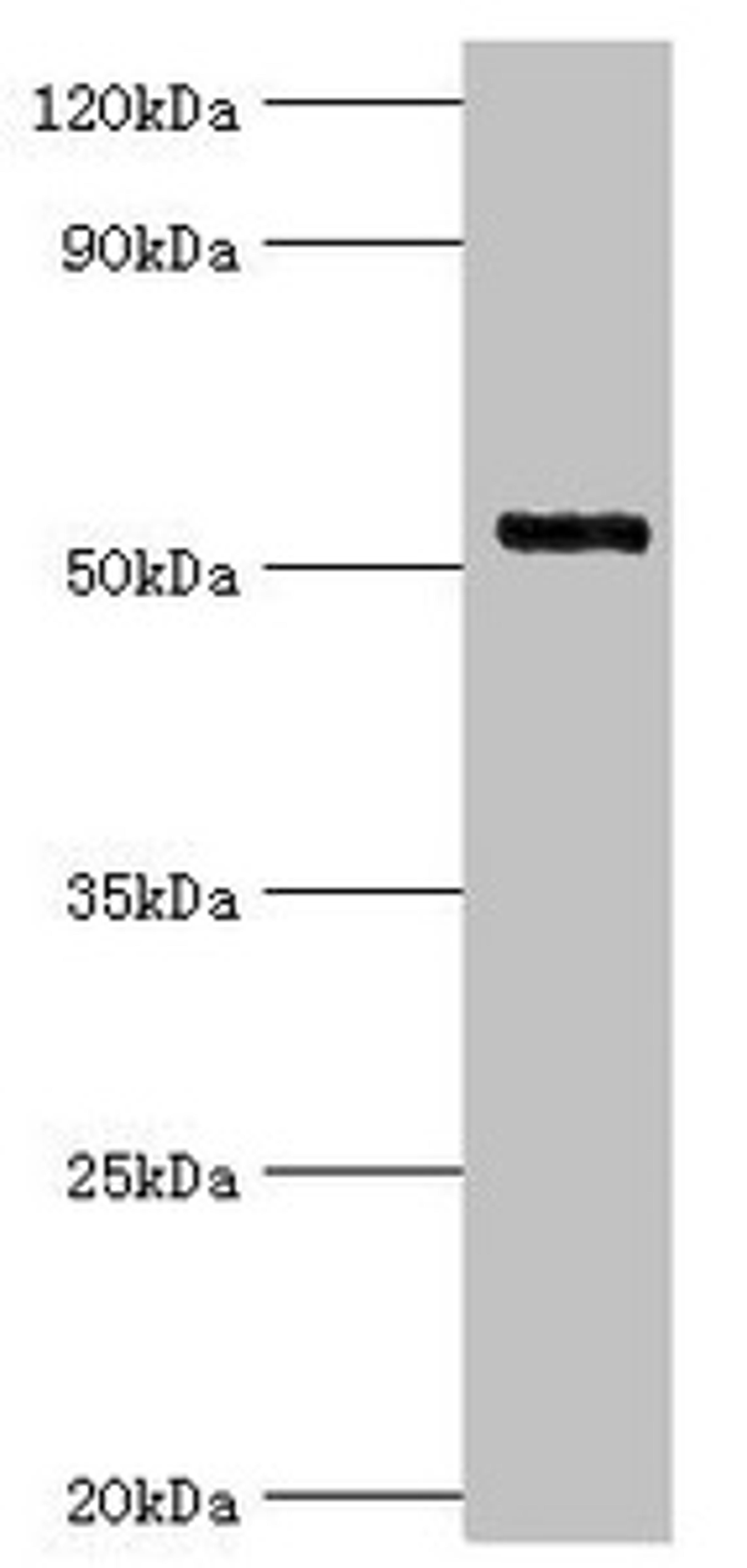 Western blot. All lanes: Interleukin-1 receptor-associated kinase 4 antibody at 4ug/ml + Jurkat whole cell lysate. Secondary. Goat polyclonal to rabbit IgG at 1/10000 dilution. Predicted band size: 52, 38 kDa. Observed band size: 52 kDa.