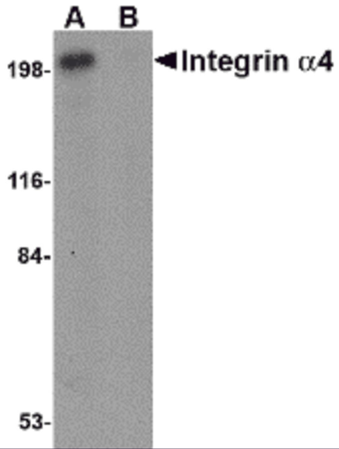 Western blot analysis of Integrin alpha 4 in Jurkat cell lysate with Integrin alpha 4 antibody at 1 μg/mL in (A) the absence and (B) the presence of blocking peptide.